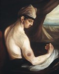 'Gunshot wound of the humerus' by Charles Bell, oil on canvas